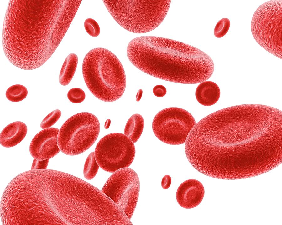 anemia