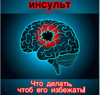 Что делать, чтобы избежать инсульта?